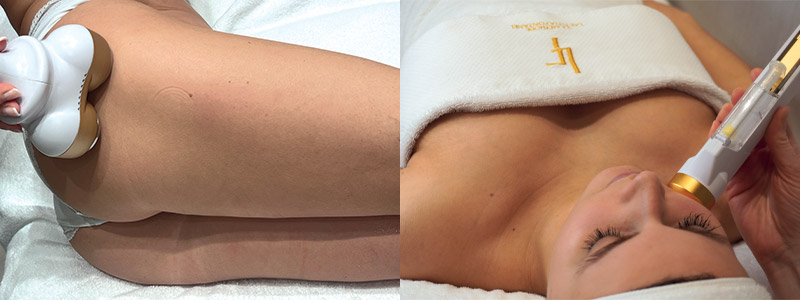 L’appareil de soin Eternelskin est une solution technologique complète, pour le corps et le visage, offrant une grande polyvalence.