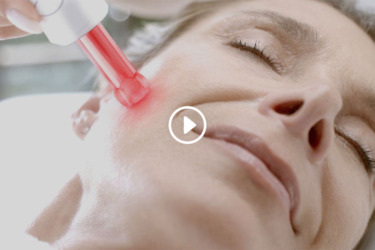 Découvrez icoone Microfacial en vidéo